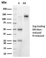 PRMT7 Antibody in SDS-PAGE (SDS-PAGE)