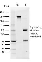 OCT-2 (POU2F2) Antibody in SDS-PAGE (SDS-PAGE)