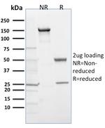 EGLN1/PHD2 Antibody in SDS-PAGE (SDS-PAGE)