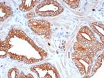 LINE1 type transposase domain containing 1/L1TD1 Antibody in Immunohistochemistry (Paraffin) (IHC (P))