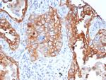 LINE1 type transposase domain containing 1/L1TD1 Antibody in Immunohistochemistry (Paraffin) (IHC (P))