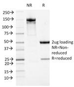 ATRX/RAD54 (Alpha Thalassemia Mental Retardation) Antibody in SDS-PAGE (SDS-PAGE)