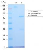 ATRX/RAD54 (Alpha Thalassemia Mental Retardation) Antibody in SDS-PAGE (SDS-PAGE)