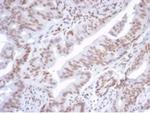 ATRX/RAD54 (Alpha Thalassemia Mental Retardation) Antibody in Immunohistochemistry (Paraffin) (IHC (P))