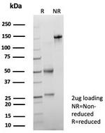 Prostate Specific Acid Phosphatase (PSAP) Antibody in SDS-PAGE (SDS-PAGE)