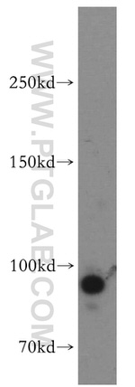 Drosha Antibody in Western Blot (WB)