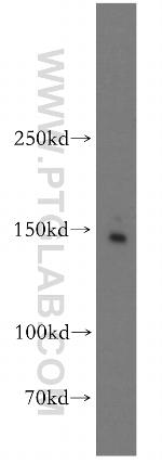 Drosha Antibody in Western Blot (WB)