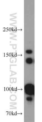 Drosha Antibody in Western Blot (WB)