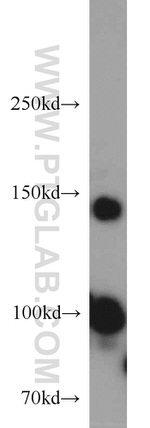 Drosha Antibody in Western Blot (WB)