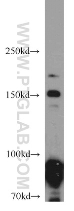 Drosha Antibody in Western Blot (WB)