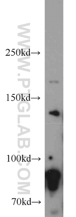 Drosha Antibody in Western Blot (WB)