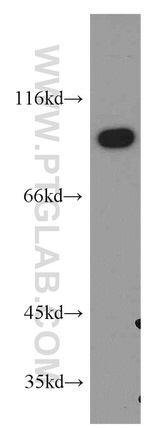 LIN41 Antibody in Western Blot (WB)