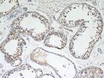 LIN41 Antibody in Immunohistochemistry (Paraffin) (IHC (P))