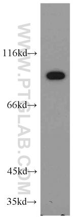 LIN41 Antibody in Western Blot (WB)