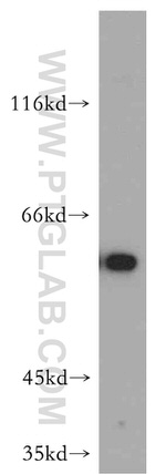 Cyclin B1 Antibody in Western Blot (WB)