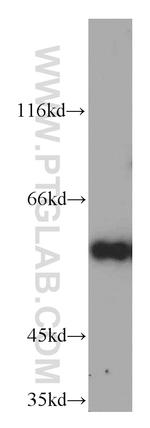 Cyclin B1 Antibody in Western Blot (WB)