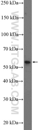 Cyclin B1 Antibody in Western Blot (WB)