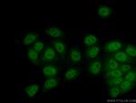 SETD1B Antibody in Immunocytochemistry (ICC/IF)