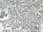 SETD1B Antibody in Immunohistochemistry (Paraffin) (IHC (P))