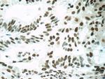 SETD1B Antibody in Immunohistochemistry (Paraffin) (IHC (P))