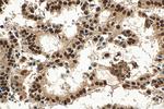 SETD1B Antibody in Immunohistochemistry (Paraffin) (IHC (P))