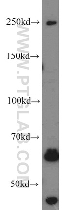 SETD1B Antibody in Western Blot (WB)