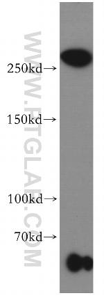 SETD1B Antibody in Western Blot (WB)