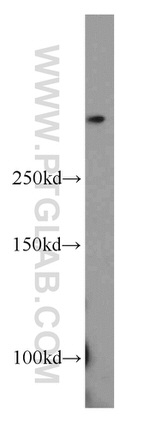 SETD1B Antibody in Western Blot (WB)