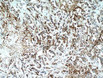 WDFY3 Antibody in Immunohistochemistry (Paraffin) (IHC (P))