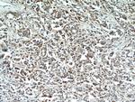 WDFY3 Antibody in Immunohistochemistry (Paraffin) (IHC (P))