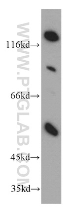 HTRA1 Antibody in Western Blot (WB)