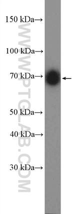 p75NTR Antibody in Western Blot (WB)