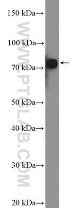 p75NTR Antibody in Western Blot (WB)