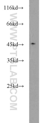 TSC22D4 Antibody in Western Blot (WB)