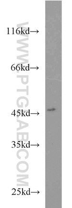 TSC22D4 Antibody in Western Blot (WB)