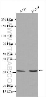 Cathepsin D Antibody in Western Blot (WB)