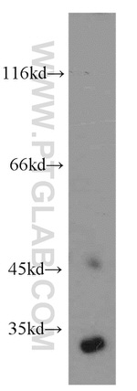 Cathepsin D Antibody in Western Blot (WB)