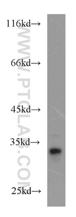 Cathepsin D Antibody in Western Blot (WB)