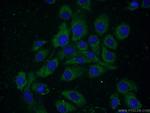 ELOVL4 Antibody in Immunocytochemistry (ICC/IF)