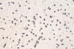 ELOVL4 Antibody in Immunohistochemistry (Paraffin) (IHC (P))