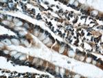 ELOVL4 Antibody in Immunohistochemistry (Paraffin) (IHC (P))