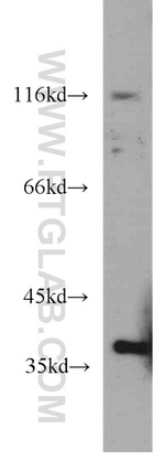 ELOVL4 Antibody in Western Blot (WB)