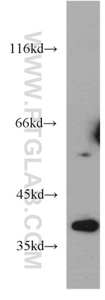 ELOVL4 Antibody in Western Blot (WB)