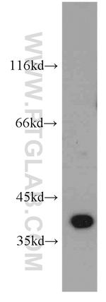 ELOVL4 Antibody in Western Blot (WB)