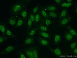 NBS1 Antibody in Immunocytochemistry (ICC/IF)