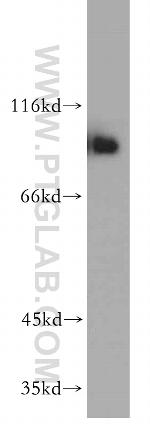 NBS1 Antibody in Western Blot (WB)