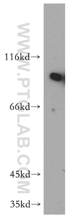 NBS1 Antibody in Western Blot (WB)