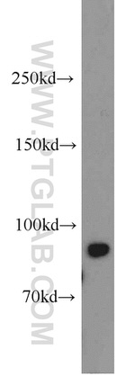 NBS1 Antibody in Western Blot (WB)