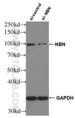 NBS1 Antibody in Western Blot (WB)