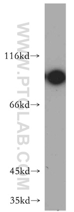 NBS1 Antibody in Western Blot (WB)